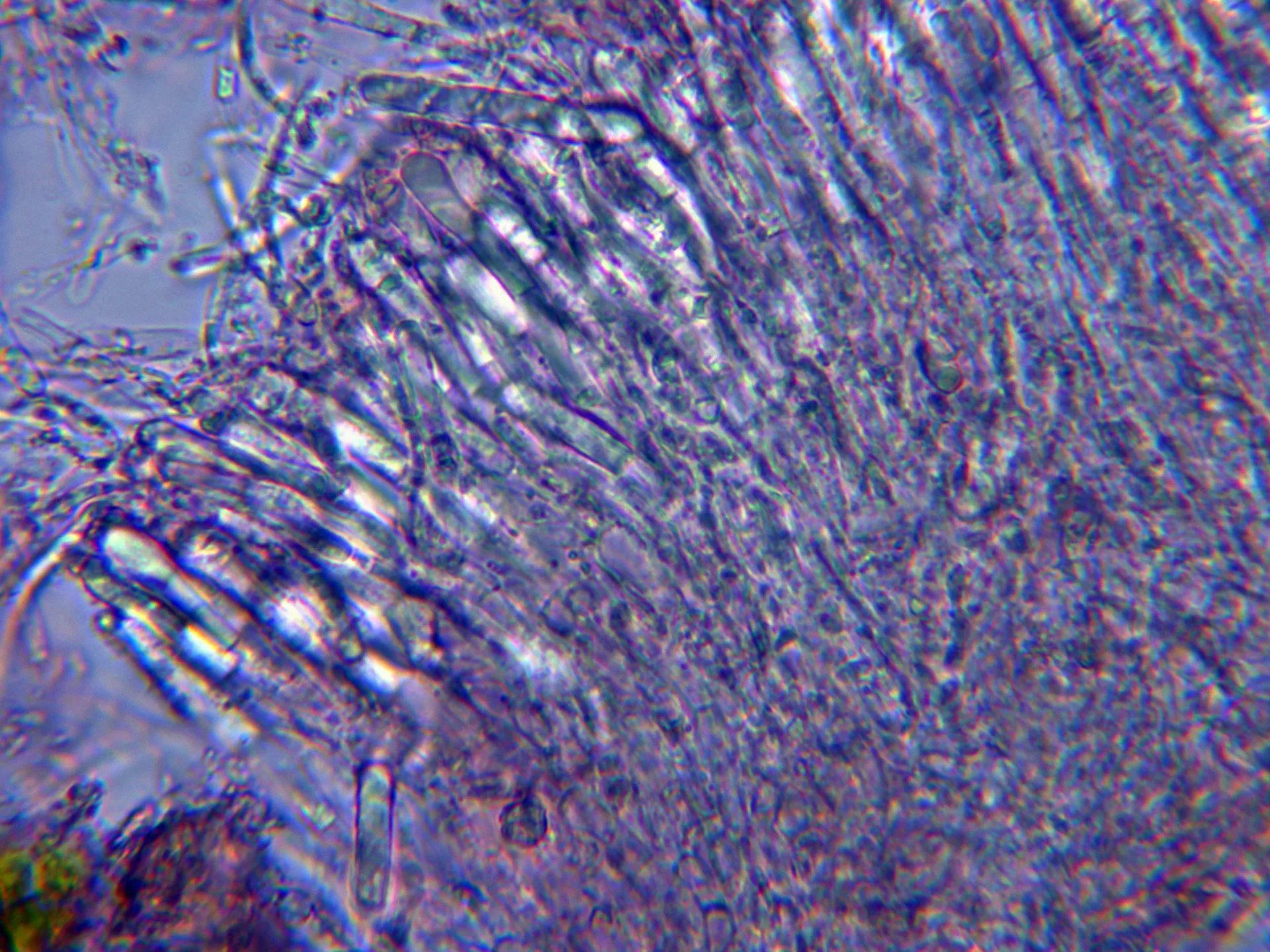 Microscopía de Pyrenopeziza benesuada - 10 - Hifas subiculares del flanco apotecial